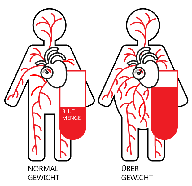 Entstehung von Bluthochdruck durch &Uuml;bergewicht